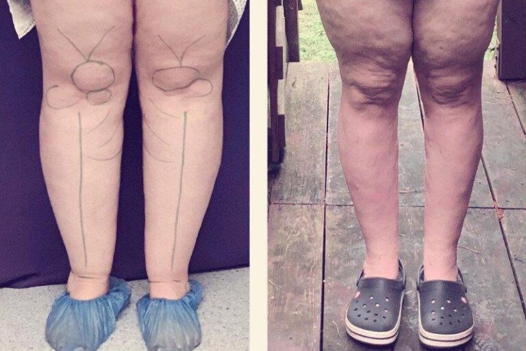 Jakie spódnice wybierać, jeśli masz grube łydki?