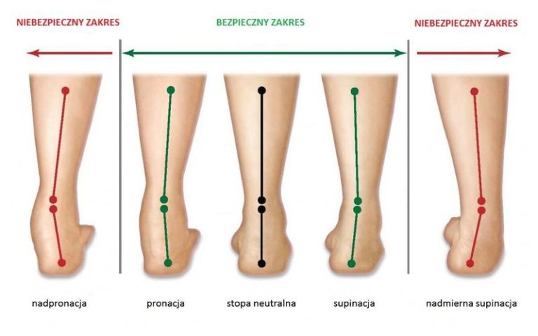 Idealne buty do wkładek supinujących – na co zwrócić uwagę przy wyborze?