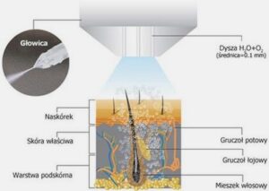 Mezoterapia bezigłowa: jakie kosmetyki warto stosować?